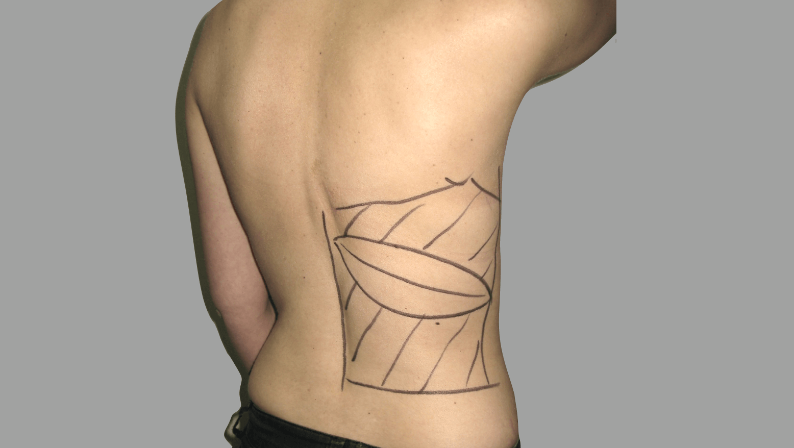 david-floyd-breast-reconstruction-delayed-LD